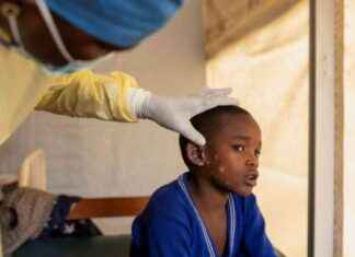 Deadly Outbreak: Mpox Claims 548 Lives in DR Congo in 2024 news-16082024-023552