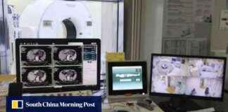 Hong Kong Health Chief: Separate Fees for MRI Scans Possible hong-kong-health-chief-separate-fees-for-mr-scans-possible